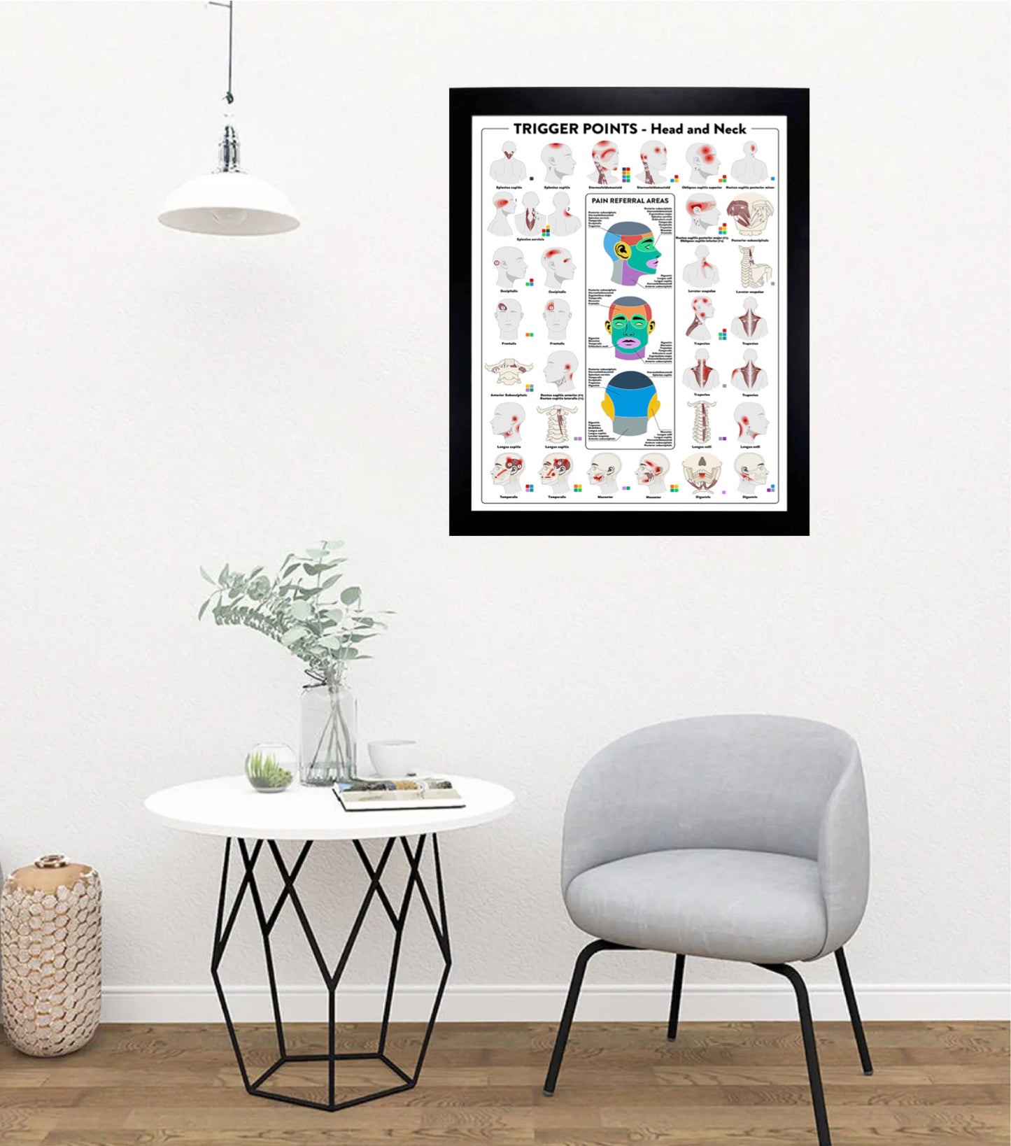 Trigger Points Poster