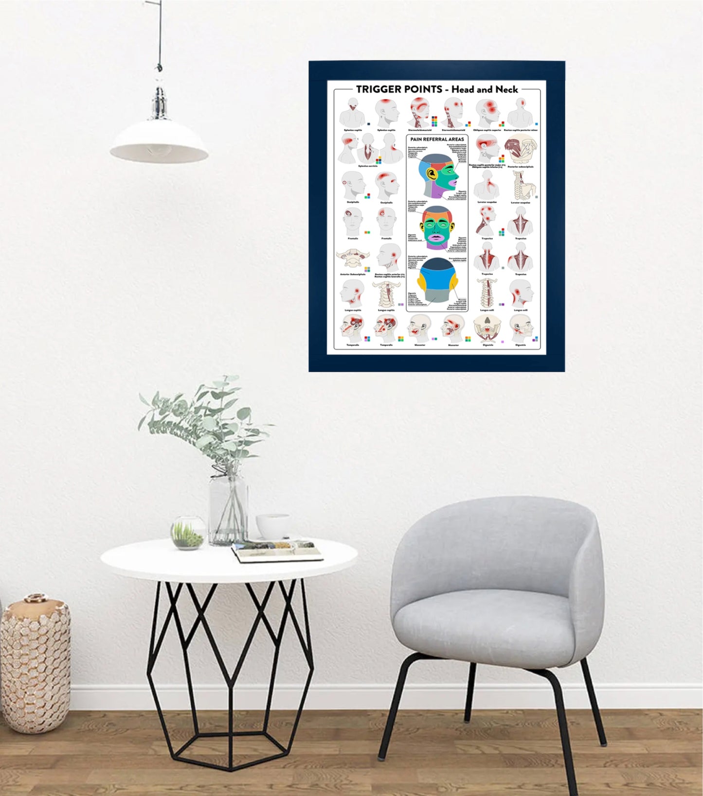 Trigger Points Poster