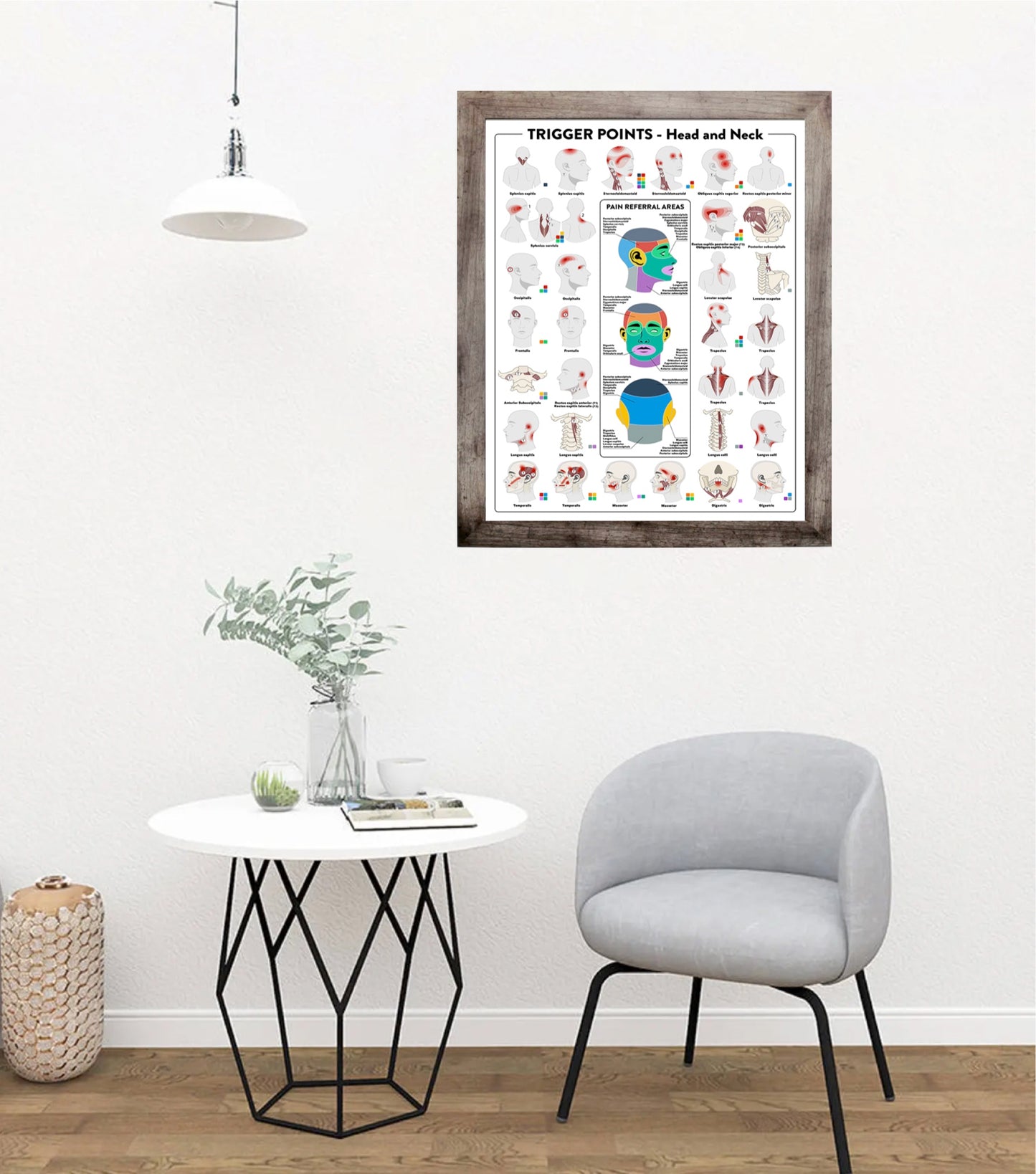 Trigger Points Poster