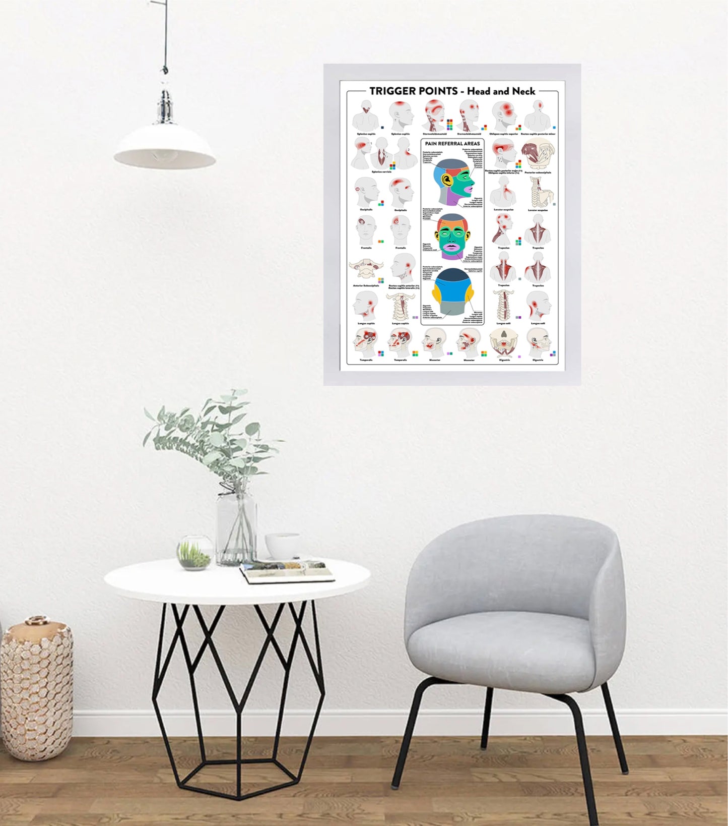 Trigger Points Poster
