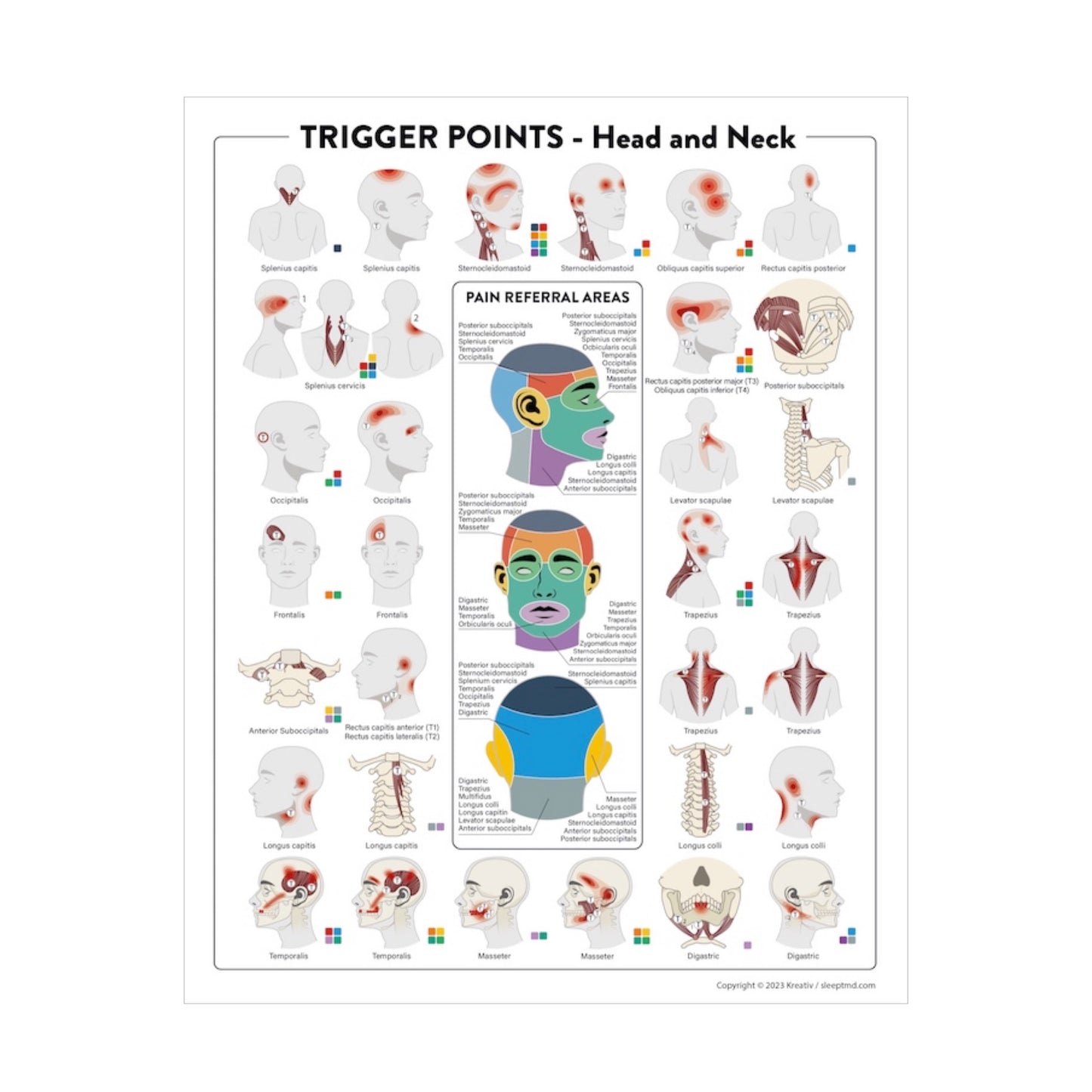 Trigger Points Poster
