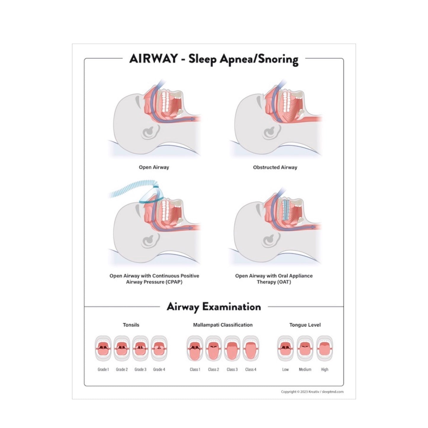 Airway Poster