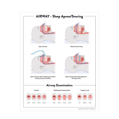 Airway Poster