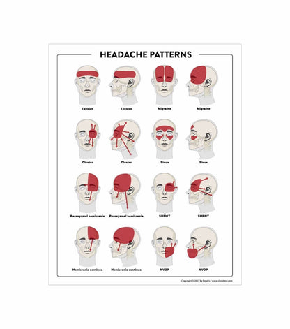 Headache Patterns Poster