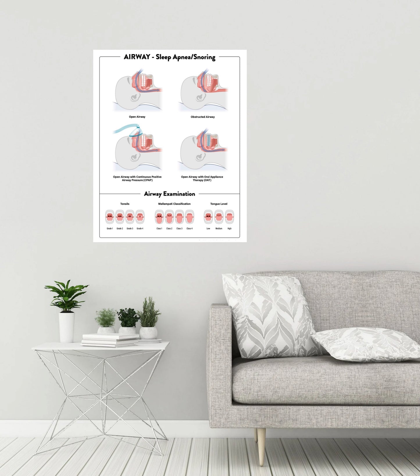 Airway Poster