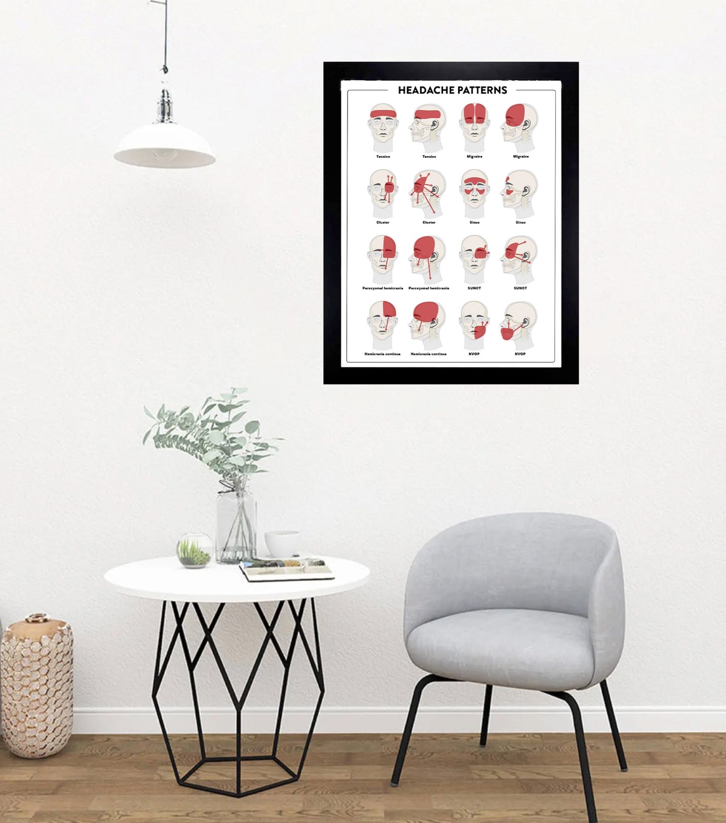 Headache Patterns Poster